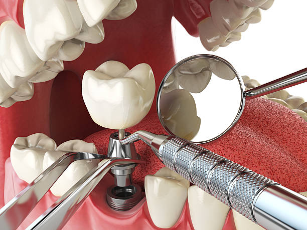 Best Emergency Tooth Extraction in Waymart, PA